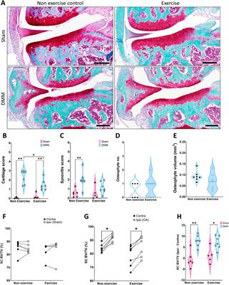 Moderate exercise protects against joint disease in a murine model of osteoarthritis